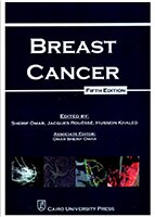 Breast Cancer