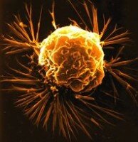 cancer-194x200